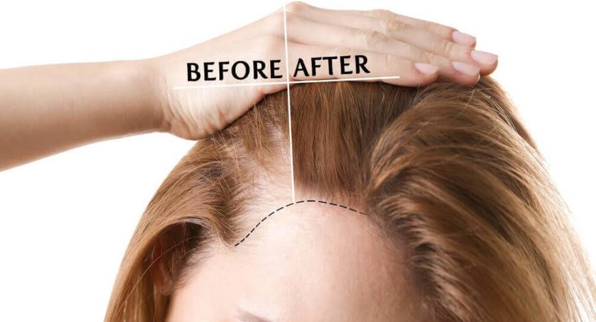 Hair loss treatment product image