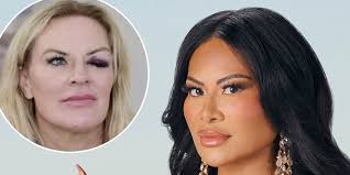 RHOSLC Reveals Unseen Jen Shah Footage & the Black Eye Truth