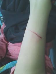 Unduh foto tangan berdarah ini sekarang. ØªÙÙØªØ± Shoofi 27 Ø¹ÙÙ ØªÙÙØªØ± Terpeleset Kepala Kena Tembok Tangan Berdarah Huhuhub Http T Co Ww3gesjspn