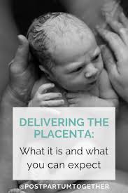 Pin On Labor And Delivery Tips Positions Interventions
