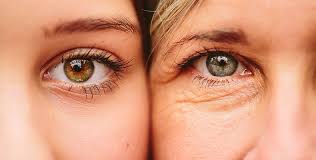 What Are IPL Treatments & Are They Right for Me?