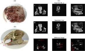 Viewing mri images requires a systematic approach. Simultaneous Imaging Of Hard And Soft Biological Tissues In A Low Field Dental Mri Scanner Scientific Reports
