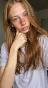 would you kiss me if my freckles were contagious?