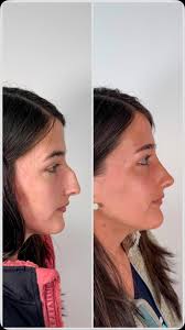 Instagram video by Dr. Juan Luis Peña Rehbein • May 30, 2024 at 6:43 PM