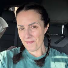 UPDADTE: I have an appointment with my plastic surgeon