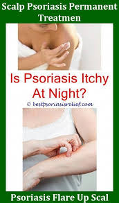 Psoriasislotion Are You Serious Psoriasis Best Lotion For Eczema And Psoriasis Dmso And Psoriasis Eczemaorpso Eczema Lotion Psoriasis Treatment Cream Psoriasis