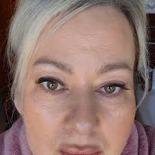 Deer resting in backyard in Bel Air, MD