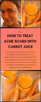 Pin On Skin Care Pimples