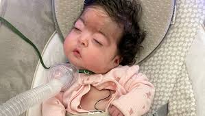 Fundraiser by Juan Rubio : Support Natalia's Bohring-Opitz Syndrome Journey