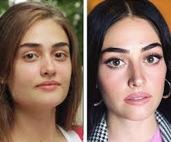 Hic Estetigim Yok Diyen Demet Sener Den Itiraf Geldi