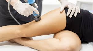 bursitis trocanterea