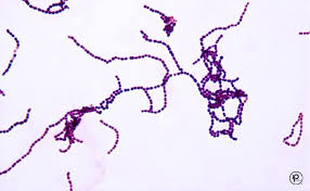 Gram positive cocci (gpc) gram neg (rods = gnr) anaerobes atypicals classification antibiotic cluster = staph. Micro Id Histology At University Of Pennsylvania Perelman School Of Medicine Studyblue Microbiology Lab Microbiology Medical Laboratory