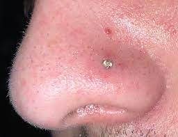 Nose Piercing Issues During A Pandemic Legitpiercing