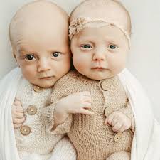 Fundraiser by Courtney Dawson : Help Mom & Dad while 3 month old Twins  Fight RSV