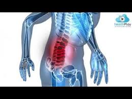 Bel Agrilari Tedavi Edilebilir Mi Prof Dr Turan Uslu Bel Fitigi Fibromiyalji Youtube