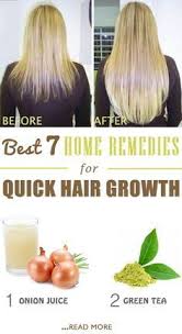 Read on to find out more about the causes, types, and home remedies for baldness in men and women. 7 Home Remedies For Quick Hair Growth Quick Hair Growth How To Grow Natural Hair Hair Growth Home Remedies