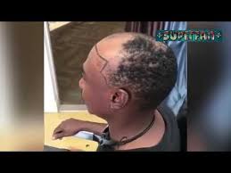 .funniest and worst hairlines i've ever seen funny hairline fails best barbers skills 10 minute edition hair cut transformation hair style how hair cut music provided by. Video Barber Hairline Fails