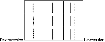 clinical evaluation of strabismus springerlink