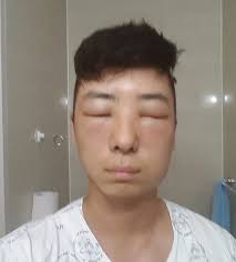 To achieve this hairstyle, cut some hair off from the side while using gel or. Korean Man S Head Balloons After Hair Dyeing Went Wrong