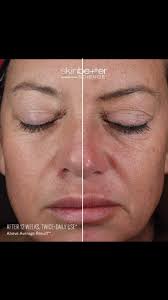 Whether you have dry, oily, or sensitive skin, 𝐍𝐄𝐖 Mystro Active Balance  Serum helps to support the skin’s natural ability to adapt to stress and  achieve balance, utilizing a purposeful blend of ...