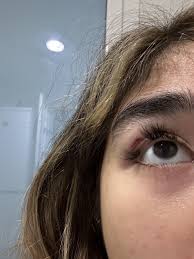 Emergency sa pilik-mata! Nadagit ko pala ang pilik-mata ko sa gym kaya may  kalbo na ngayon. : r/beauty