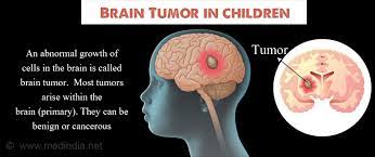 Problems speaking clearly, swallowing, or walking headaches along with vomiting, especially in the morning Brain Tumor In Children Types Causes Symptoms Diagnosis Treatment