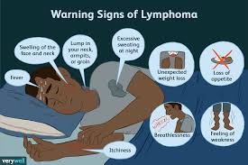Image result for Lymphoma