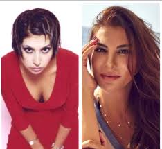 Eski Hali Soke Etti Ebru Yasar In Gozleri Haric Her Yeri Estetik Cikti Magazin
