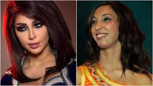 عمليات التجميل تغي ر ملامح النجمات العرب الفرق واضح مجلة سيدتي