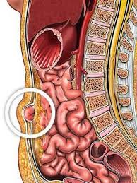 Bring your hands up to your head, and lift your. Types Of Hernia Everyday Health