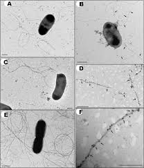 Maybe you would like to learn more about one of these? Expression Of A Novel Class Of Bacterial Ig Like Proteins Is Required For Inchi Plasmid Conjugation