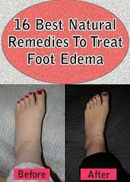 Pin On Remediesforbody