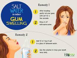Warm and cold compresses can provide quick relief for sore, swollen gums as they help reduce pain and swelling. Home Remedies To Reduce Gum Swelling Top 10 Home Remedies