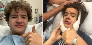 He suffers from a rare genetic condition called cleidocranial dysplasia, in which. 14 Zahne Extrahiert Netflix Star Gaten Matarazzo Erneut Operiert Zwp Online Das Nachrichtenportal Fur Die Dentalbranche