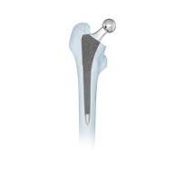 PBG Proximal Bone Growth Cementless Stem,Medical Device ...