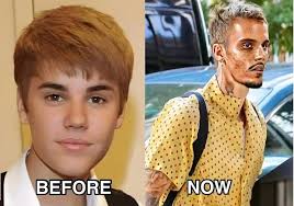 Justin Bieber admits that he tested positive for…See More