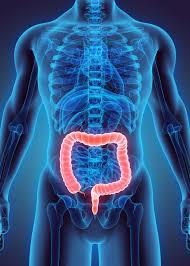 Image result for Ulcerative Colitis