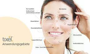 Vorher nachher videos und bilder sind inkludiert. Tixel Faltenbehandlung Klinik Dr Katrin Muller