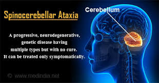 Image result for Ataxia