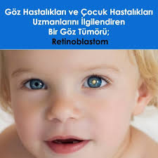Cocukluk Caginin En Yaygin Goz Ici Kanser Turudur Hastalarin Yetkin Merkezlerde Tedavisi Gereklidir Http Www Kadircank Cocukluk Saglik Biliyor Muydunuz