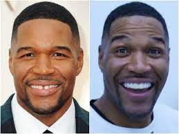 On thursday, he revealed it was an april fool's day prank. Michael Strahan Posts Video Of Dentist Closing His Signature Teeth Gap
