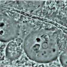 Hanny s voorwerp official website of discoverer hanny van arkel. Magnification 1000x Typical Amoeba Surrounded By Neutrophils Bacilli Download Scientific Diagram