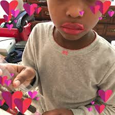 Fruits in the Morning