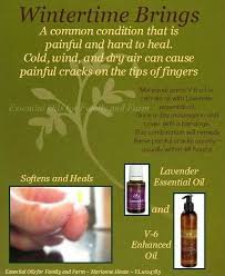 Pin On Young Living Essential Oils