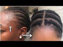 How I Grow My Damaged Edges Fast 4 Products I Used 4 Things I Stopped Doing Shocking Resul How To Grow Natural Hair Natural Hair Styles Thick Hair Growth