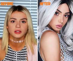 Facetune Plastic Surgery Vice |