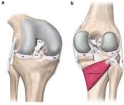 Maybe you would like to learn more about one of these? Evolving Evidence In The Treatment Of Primary And Recurrent Posterior Cruciate Ligament Injuries Part 1 Anatomy Biomechanics And Diagnostics Springerlink