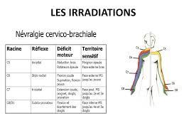 En regard de chaque disque cervical, une racine nerveuse quitte la moelle et le canal rachidien par le foramen (trou). 2 Eme Congres National De Medecine De Generale De Bejaia Ppt Telecharger