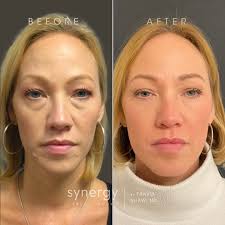 Whitney Lange, MSN, NP, CANS (@injections.by.whitney) · Richmond, VA