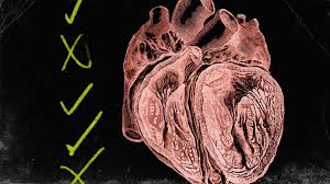 Image result for HEART Score